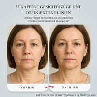 Glimnix™ CollaWave