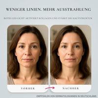 Glimnix™ ElasticGlow Maske