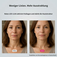 Glimnix™ ElasticGlow Maske