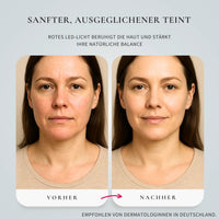 Glimnix™ CollaWave - Glimnix