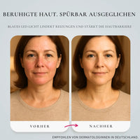 Glimnix™ ElasticGlow Maske - Glimnix