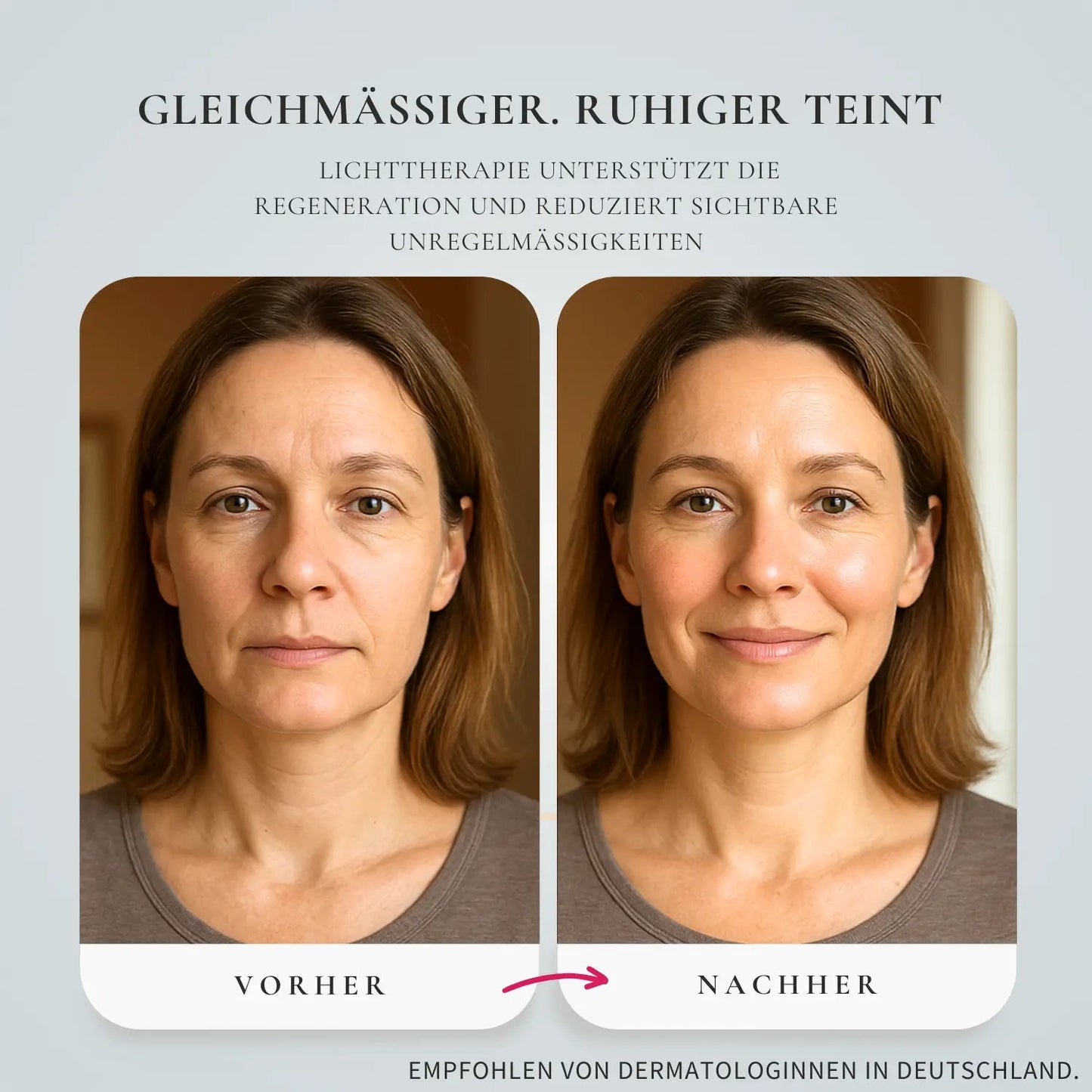 Glimnix™ LumiLift - Glimnix