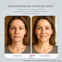 Glimnix™ LumiLift - Glimnix